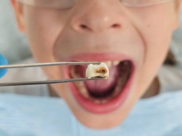 Best Emergency Treatment for Toothache in Kadelphia, AR